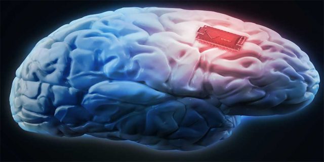 Brain implant combat problem gambling